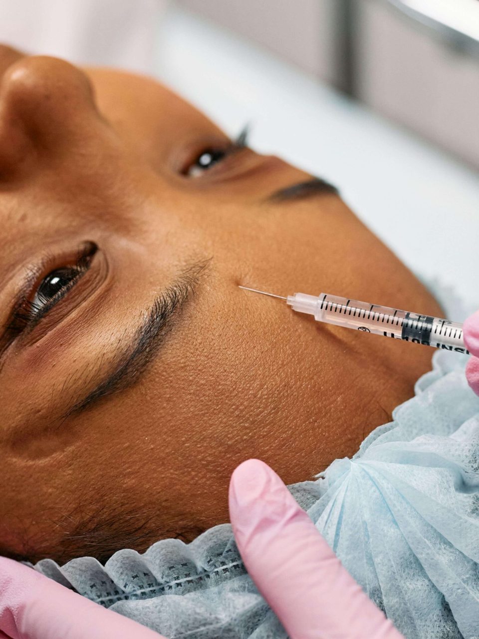 botox